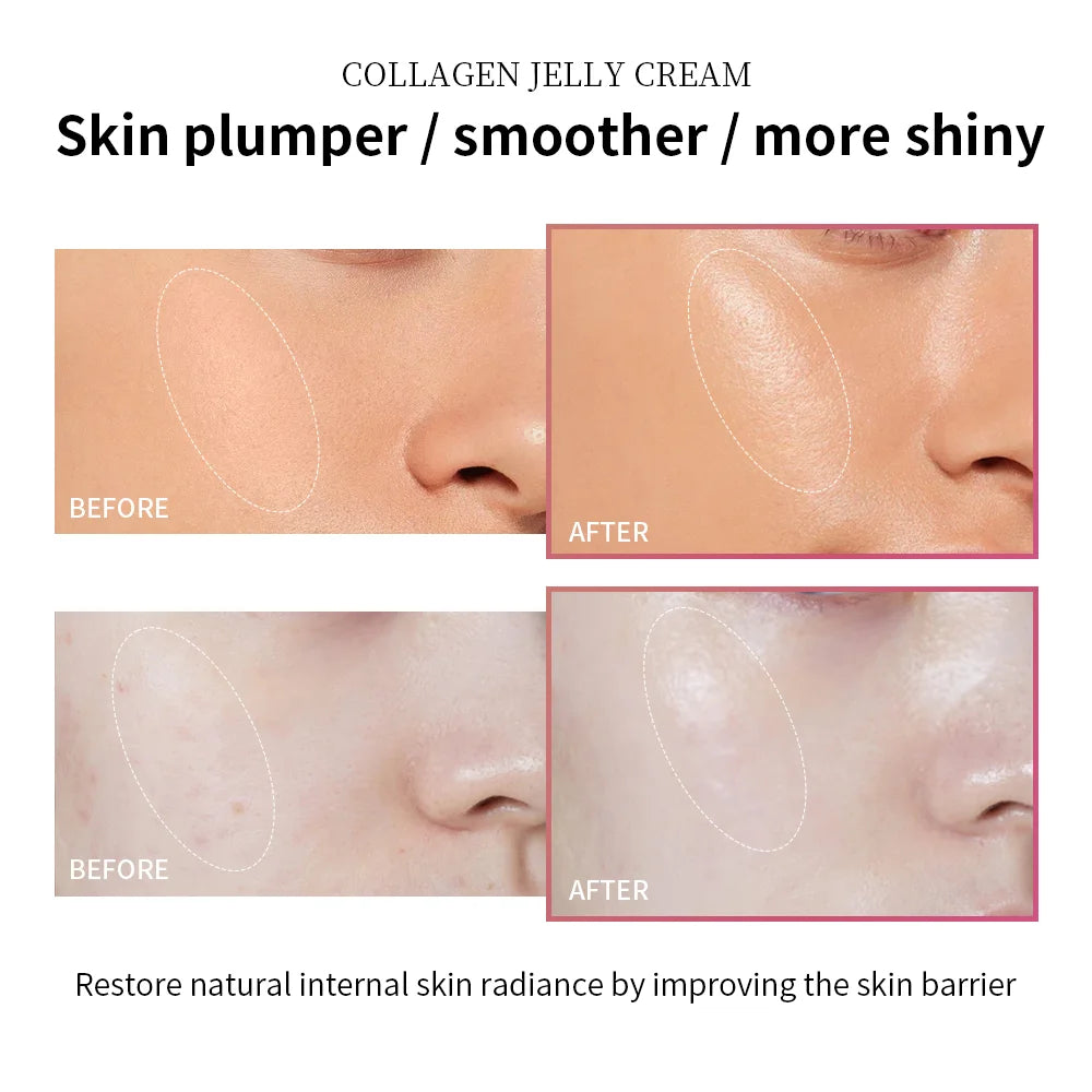 Ibcccndc Deep Hydrating Collagen Jelly Face Cream
